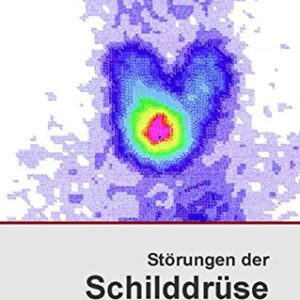 Störungen der Schilddrüse (Aus der Sprechstunde)
